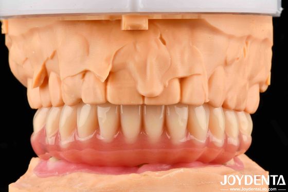 Natürlich aussehende Acrylpräparate mit hoher Biokompatibilität
