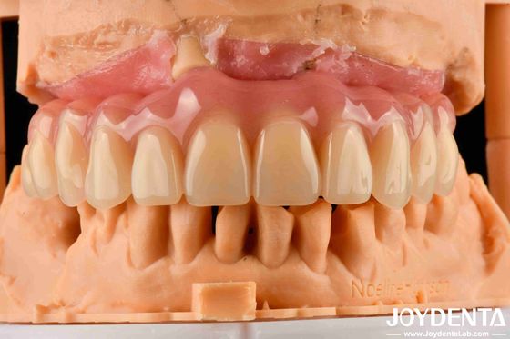 Komfortable Acryl-Zahnprothese mit Zahntechnik