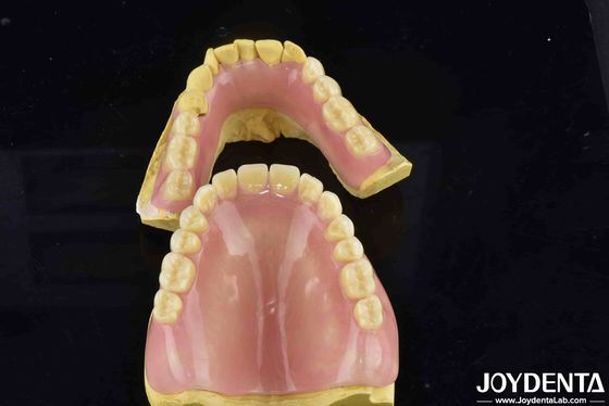 Natürliche Zahnmorphologie Flexible Zahnprothese Zahnveredelung für bequeme sichere Passform