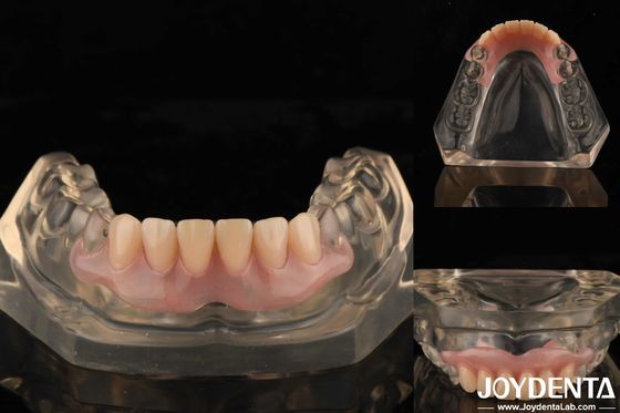 Technologie zur Zähnenanordnung Flexible Zahnersatz Finish Hohe Elastizität Anpassung