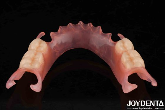 Komfortable Zahnprothese Flexible Zahnprothese mit hochgradigem Stealth