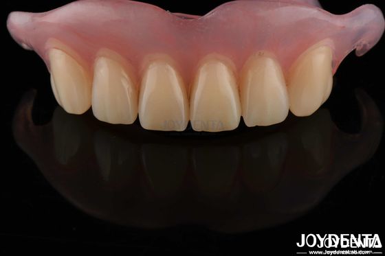 High Stealth Flexible Removable Zahnersatz fertig Komfortabel Fit Zahnlabor