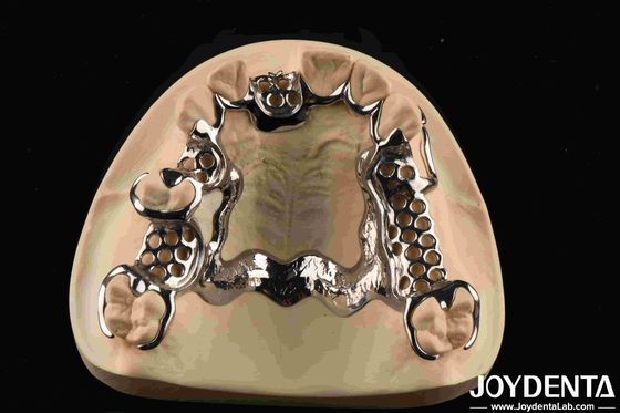 angepasste Ausstattung Metallrahmen Dental Biokompatibles Material