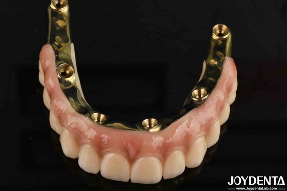 Zahnprothese Ti-Bar Zirkonia Hybridbrücke mit hohen Biokompatibilitätsstandards