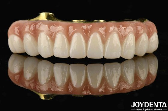 Titanium und Zirkonia Komfort Komfortabel zu tragen Ti-Bar Zirkonia Hybridbrücke zum Ersetzen von fehlenden Zähnen