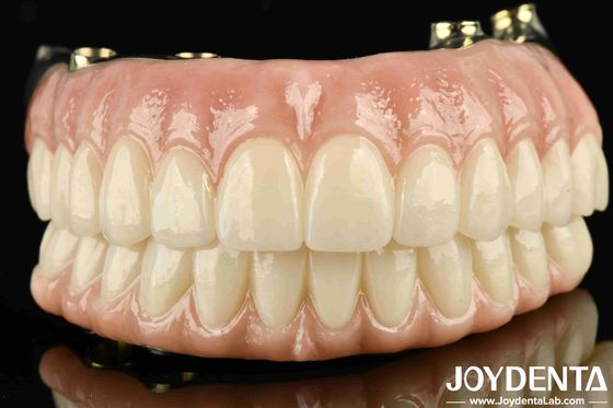 High-Durability Ti-Bar Zirkonia Hybrid Brücke kundenspezifisch für persönliche Zufriedenheit garantiert