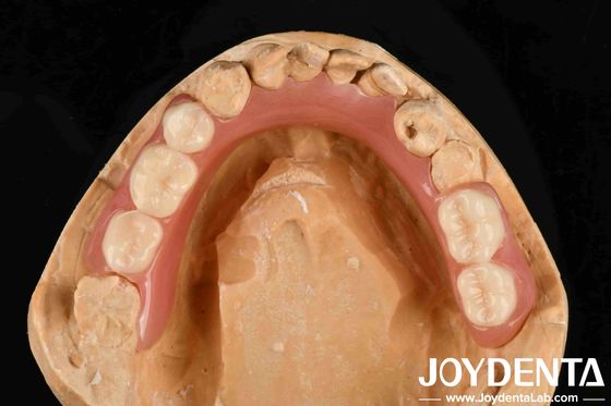 Persönliche Anpassung Akryl-Zahnprothese Finish gute Elastizität und Leichtgewicht Eigenschaft für verbesserte Prothese Leistung