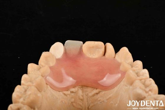Hohe Stealth gute Elastizität Flexible Zahnersatz für verschiedene Herstellungsprozesse