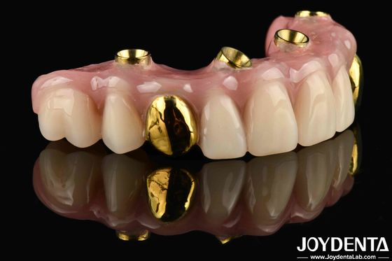 50 ml Dentwre aus den Vereinigten Staaten Ihre ultimative Lösung Ti-Bar Acryl Zahnveredelung für die Zahnbehandlung