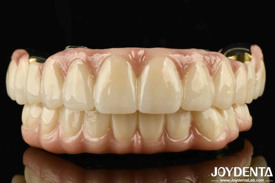 Ausgezeichnete Festigkeit Ti-Bar Zirkonia Hybridbrücke für natürliche Zähne und Zahnfleisch Kompatibilität