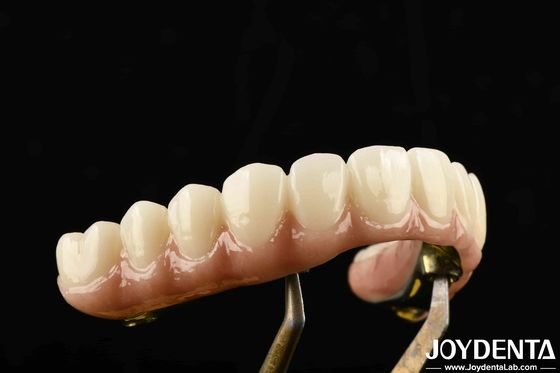 Dauerhafte Ti-Bar Zirkonia Hybridbrücke aus Titan und Zirkonia Materialien für schwere