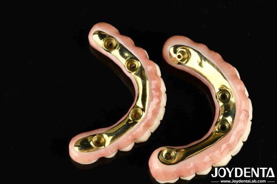Natürliche Ästhetik Zirkonia Hybridbrücke mit hoher Haltbarkeit und Biokompatibilität Ti-Bar Zirkonia Hybridbrücke