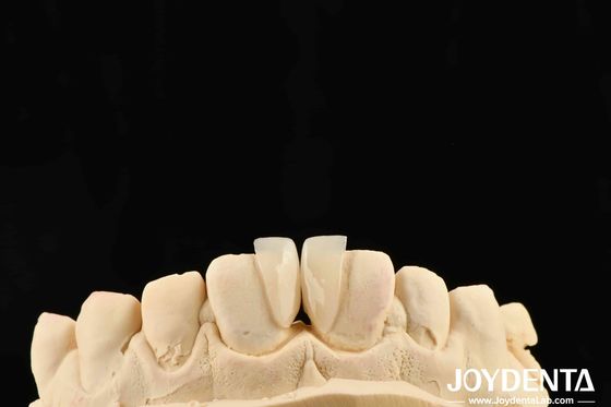 Hohe Haltbarkeit Mikrofolie 0,2 mm Dicke und zuverlässige Leistung