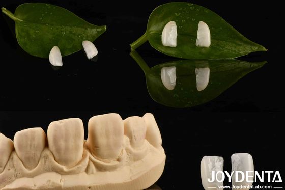 Hohe Haltbarkeit Ultrathin Micro Veneer mit Naturholz 0,2 mm Dicke