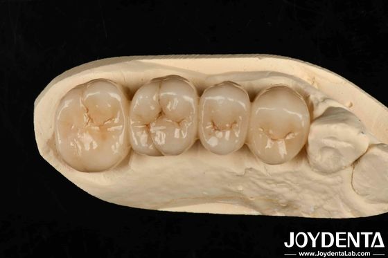 Mehrschichtiger Vollzirkonia Weiß Stil mit Schichten Hohe Durchsichtigkeit Hohe Widerstandsfähigkeit gegen Riss