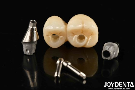 Präzises Implantat-gestütztes Kronenbrücke-System mit Beständigkeit gegen Flecken und Verfärbungen