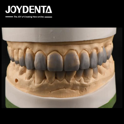 Vorübergehende Verwendung Diagnostische Wachs-Ups Glatte Textur Zähne Wachs-Up Custom