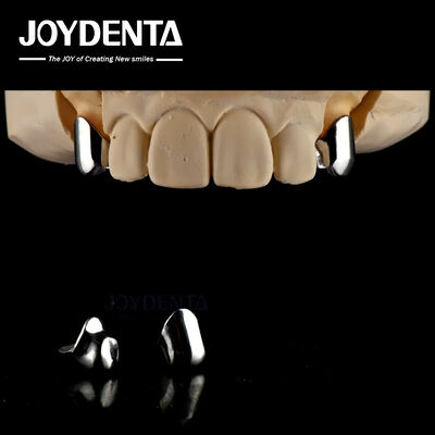 Präzisionsentfernbare Prothese Zahnimplantate Anschlüsse Einfach sauber Komfortabel passen