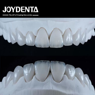 Natürlich aussehende Emax Porzellan Veneer Komfortabel passend Ultra dünne Emax Veneers